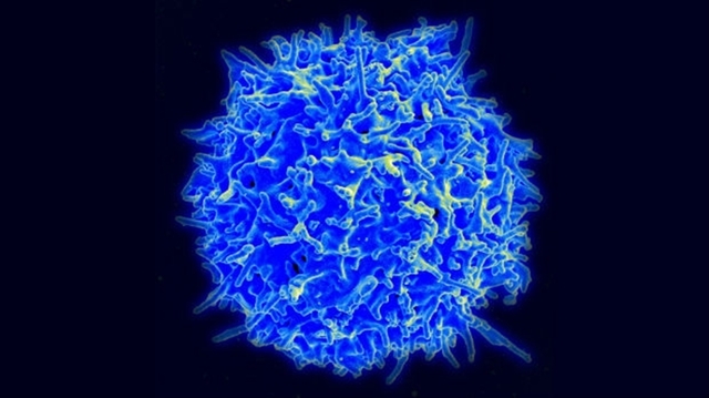 Neuroblastoma.jpg