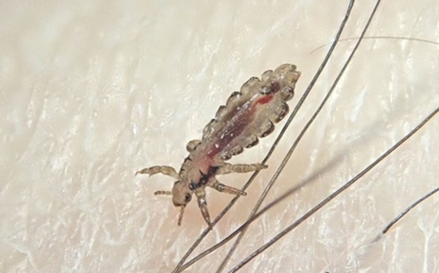 atama-jirami.jpg
